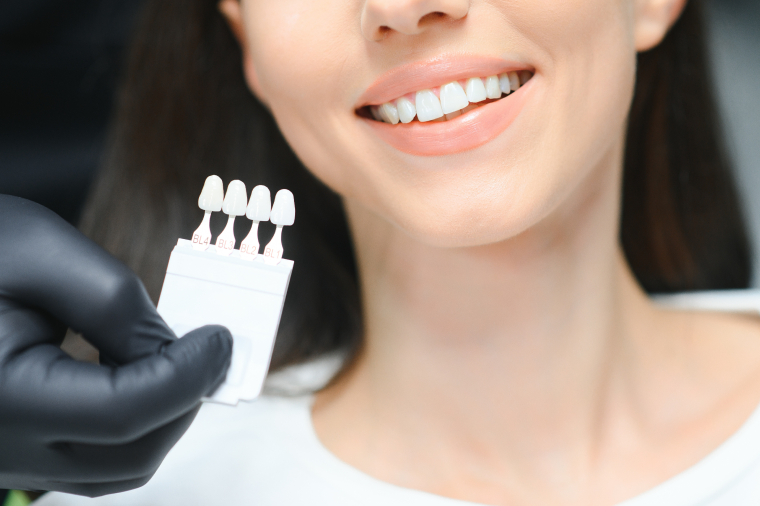 teeth-whitening-winnipeg