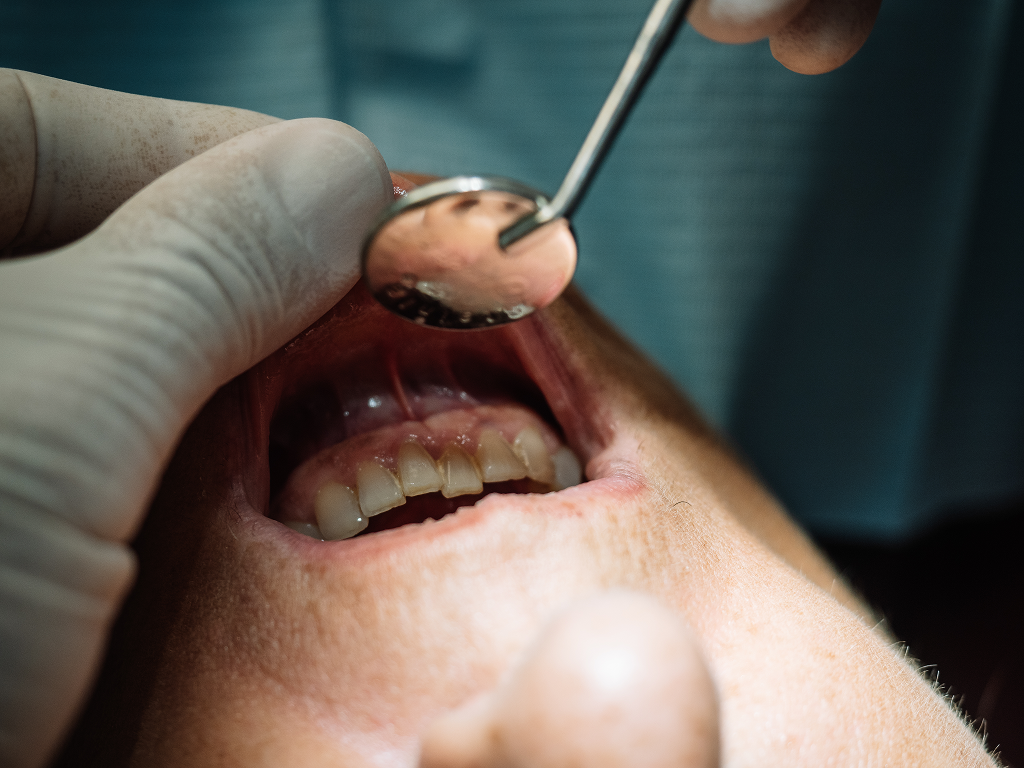 Dentist opens the mouth of a patient with periodontal disease