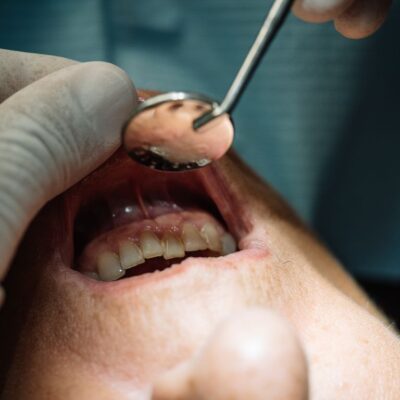 dentist checking a patients mouth for periodontal disease
