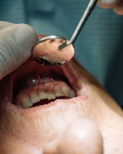 dentist checking a patients mouth for periodontal disease