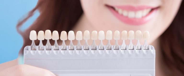 Everything You Need to Know About Porcelain Veneers