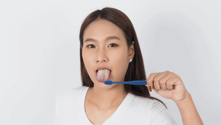 What Is Oral Thrush & How to Get Rid of It