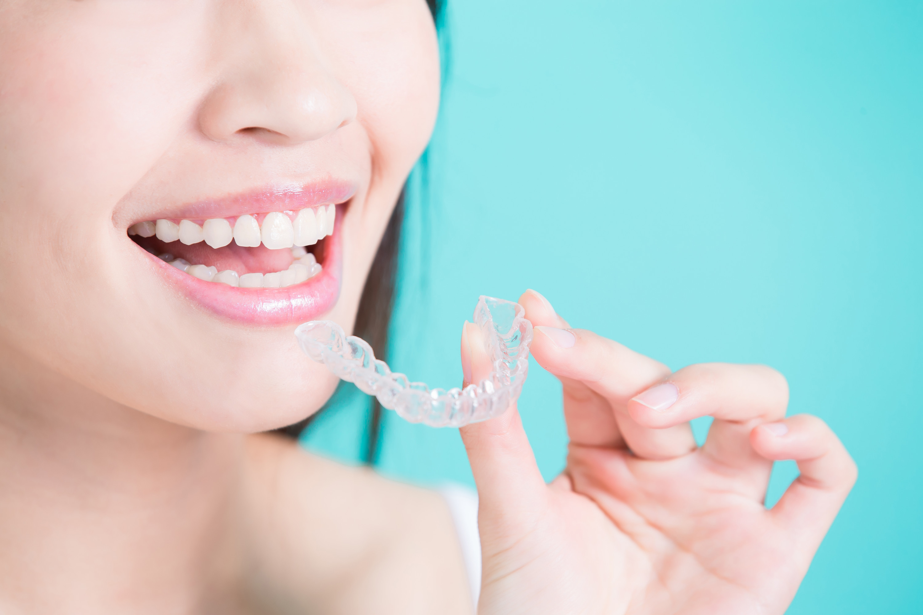 Invisalign Before and After: Kim's Journey With Clear Aligners