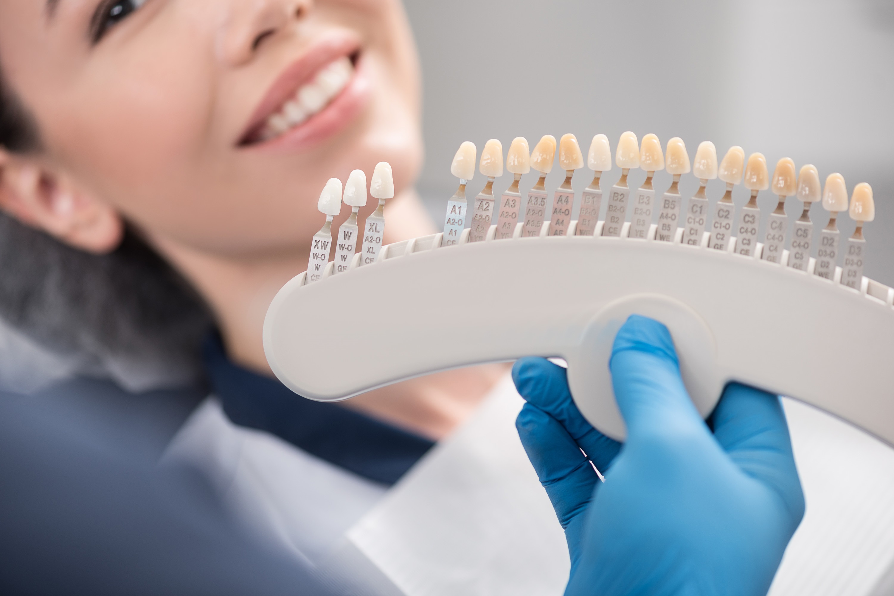 how do dentists improve yellow teeth
