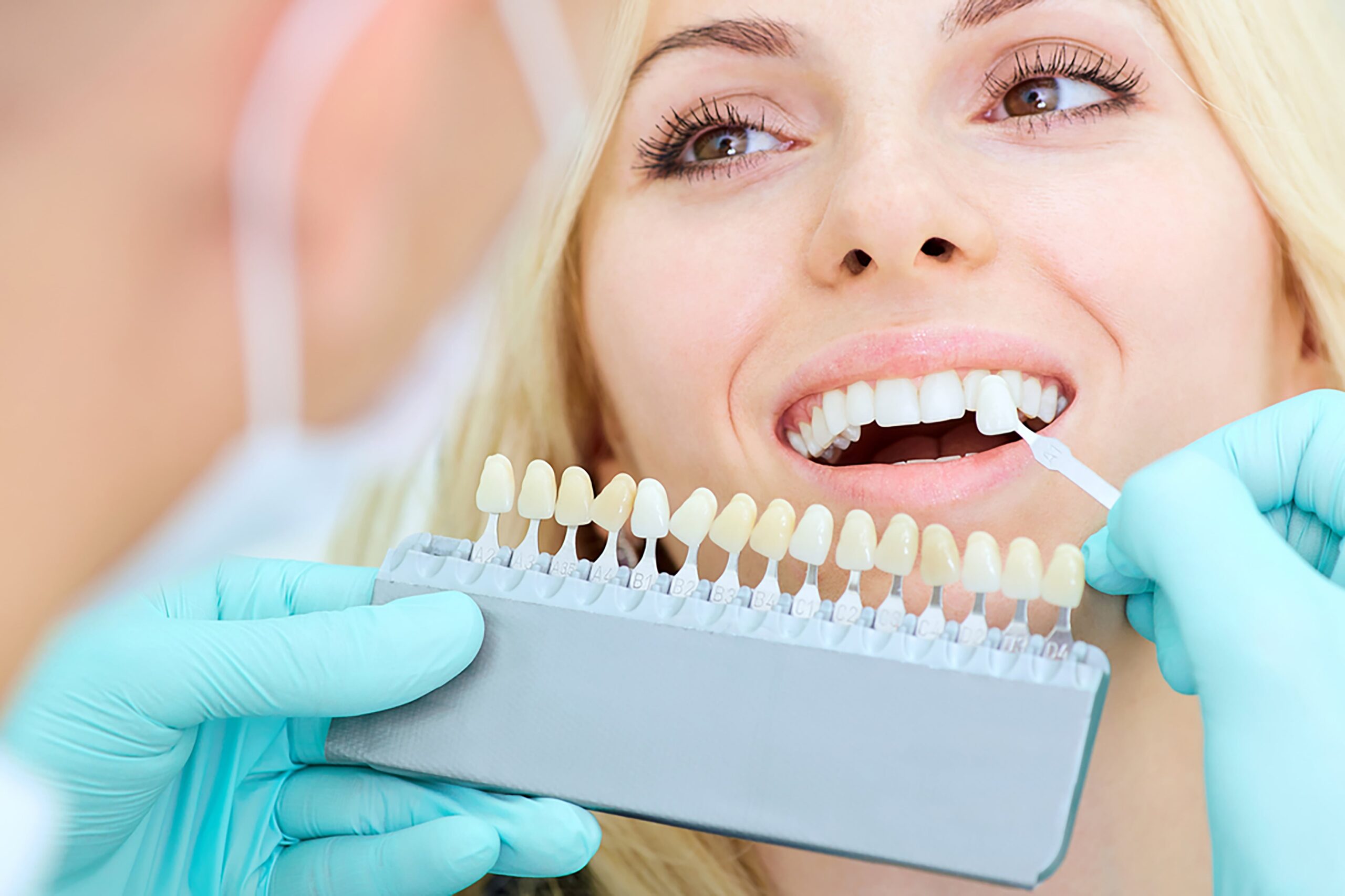 All You Need to Know About Laser Teeth Whitening