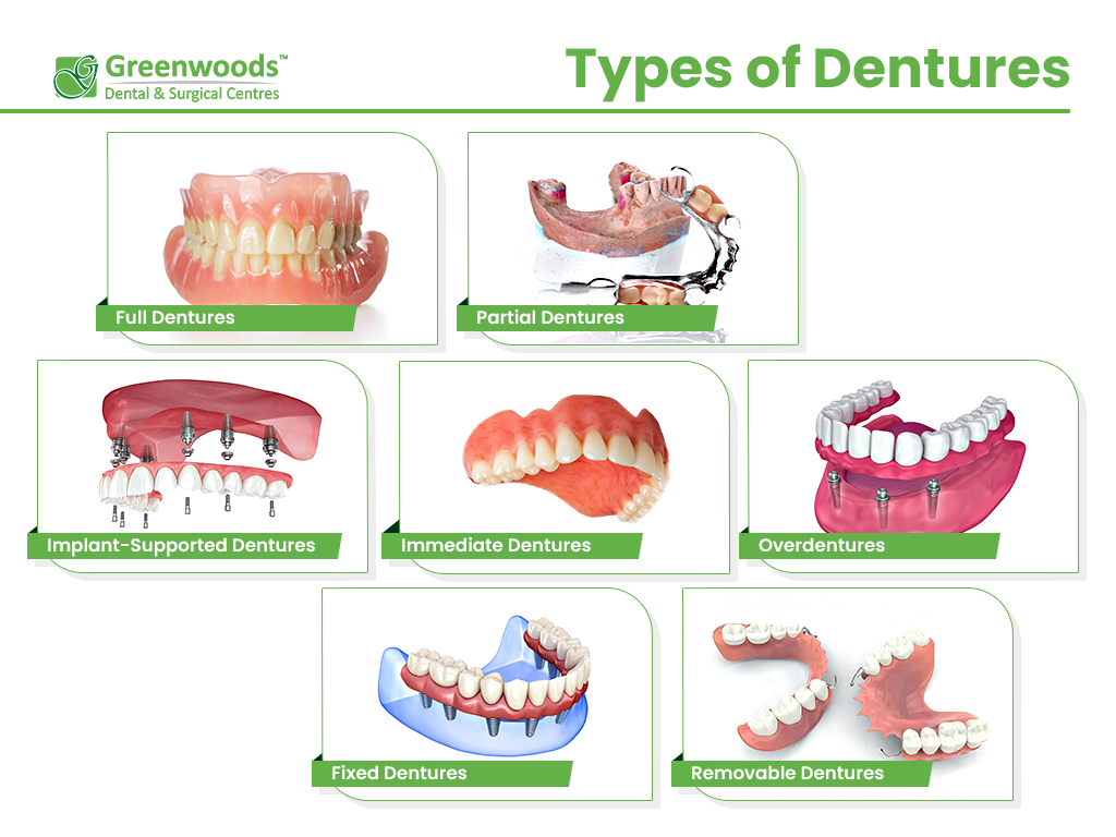 Different Types of Dentures