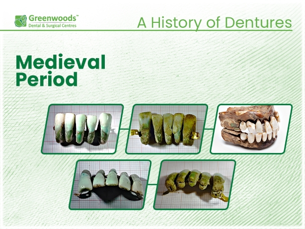 medieval period dentures 