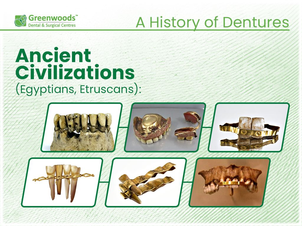 ancient civilization dentures