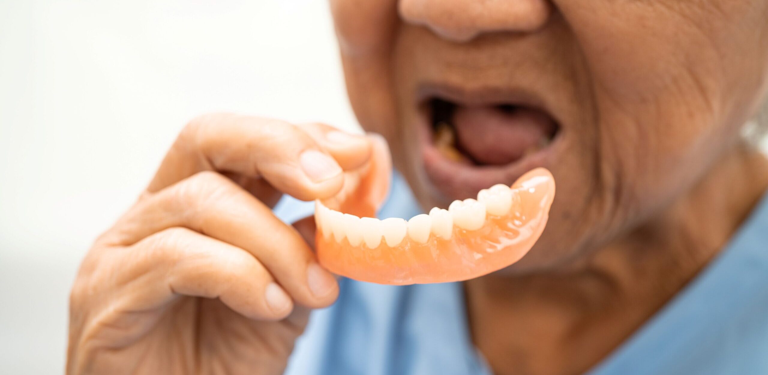 When Your Dentures Don’t Fit Like They Used To: A Guide To Dental Relining