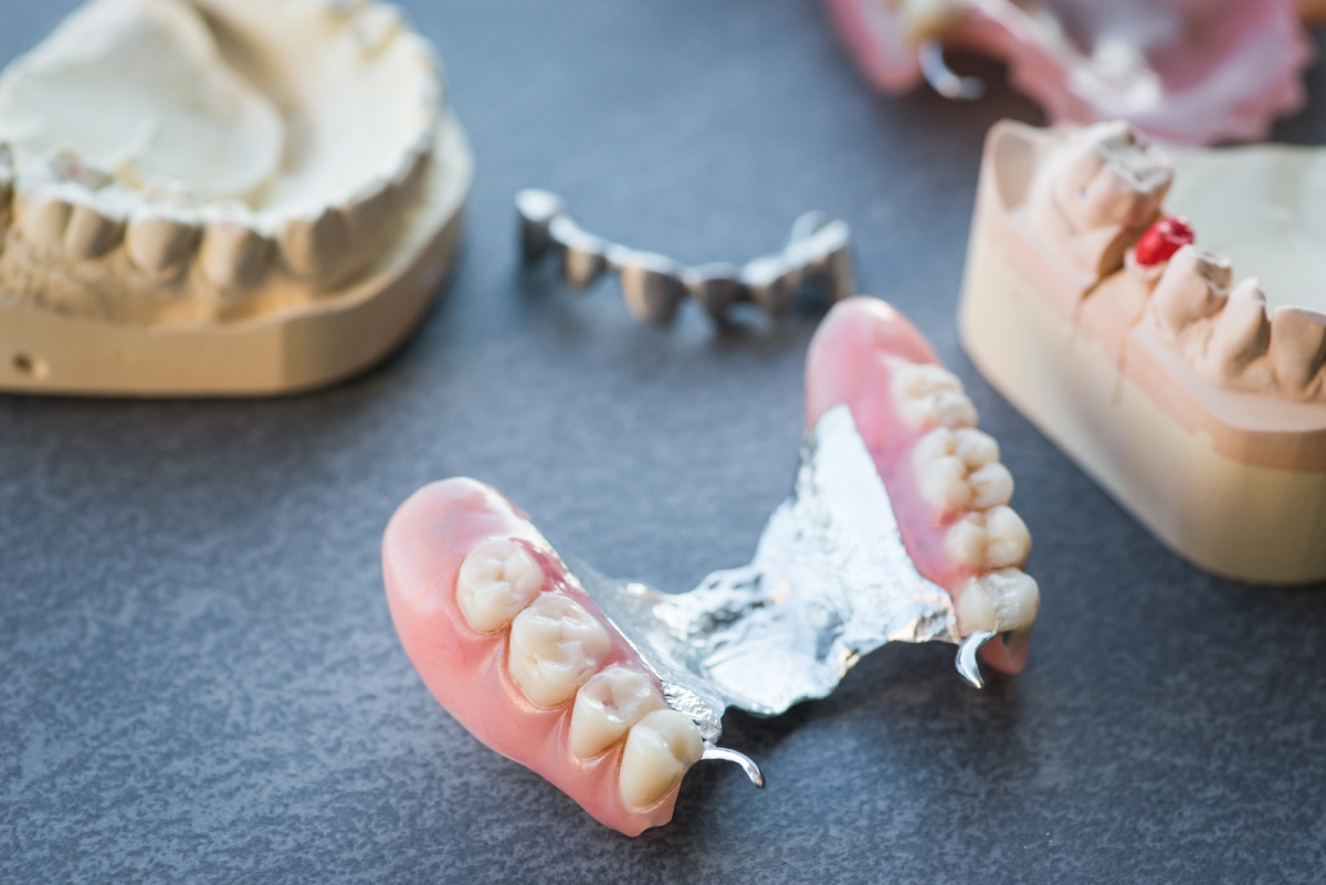 Dentures Relined: Everything You Need to Know