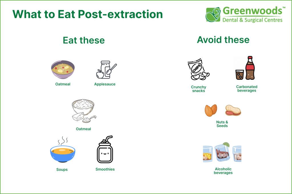 Post-tooth extraction foods 