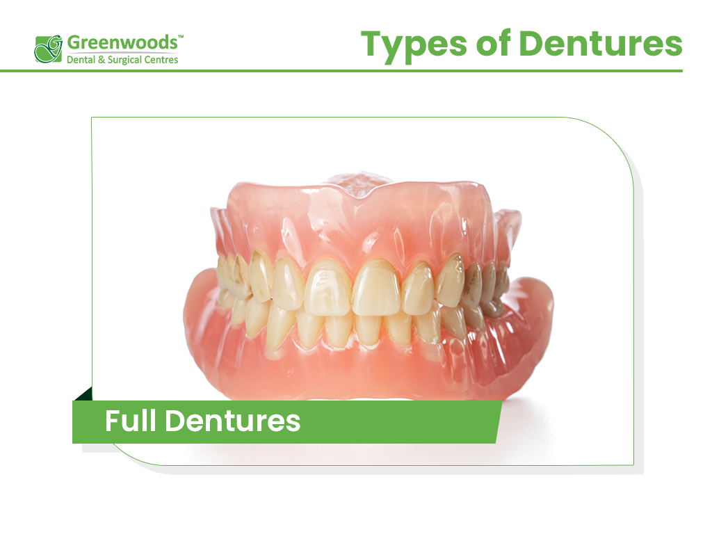 Full Dentures at Greenwoods Dental Clinic