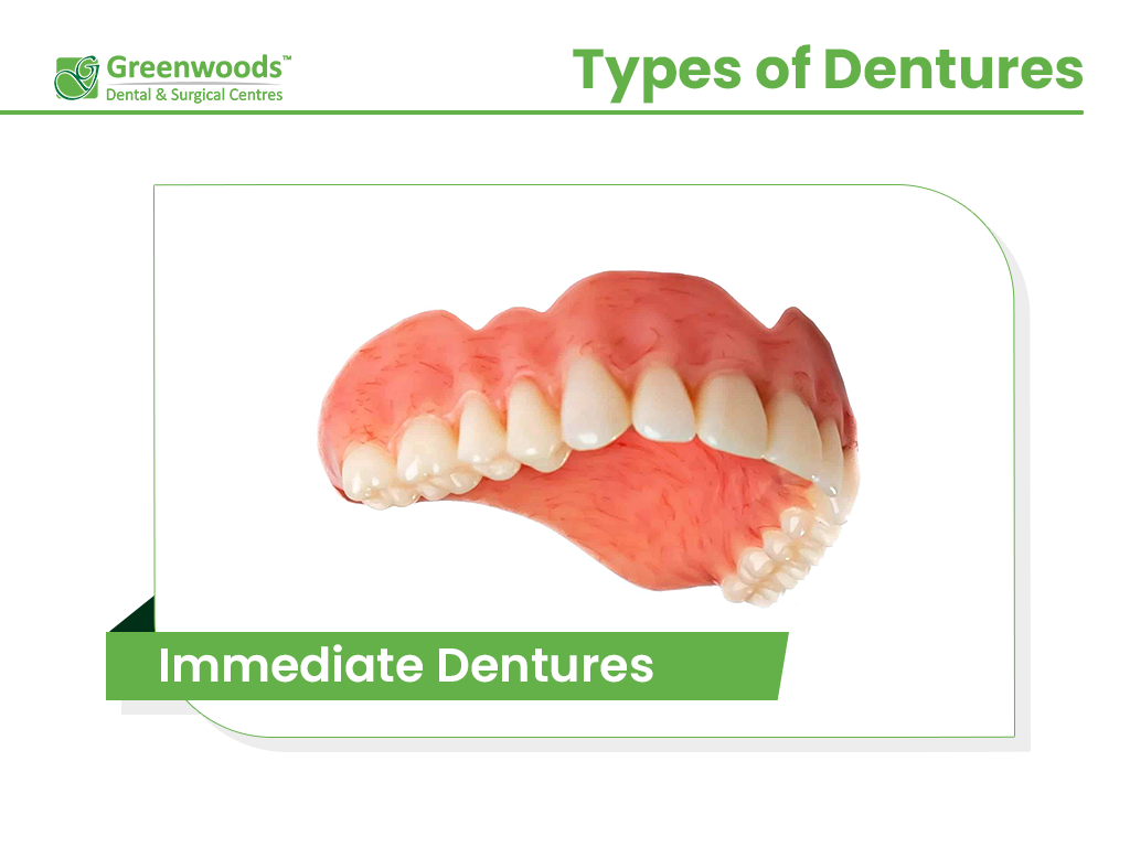 Immediate Dentures at Greenwoods Dental Clinic in Winnipeg