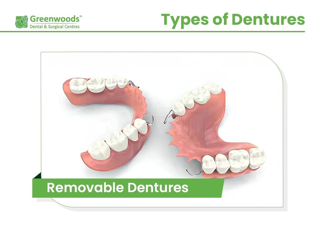 Removable Dentures from dentist in Winnipeg