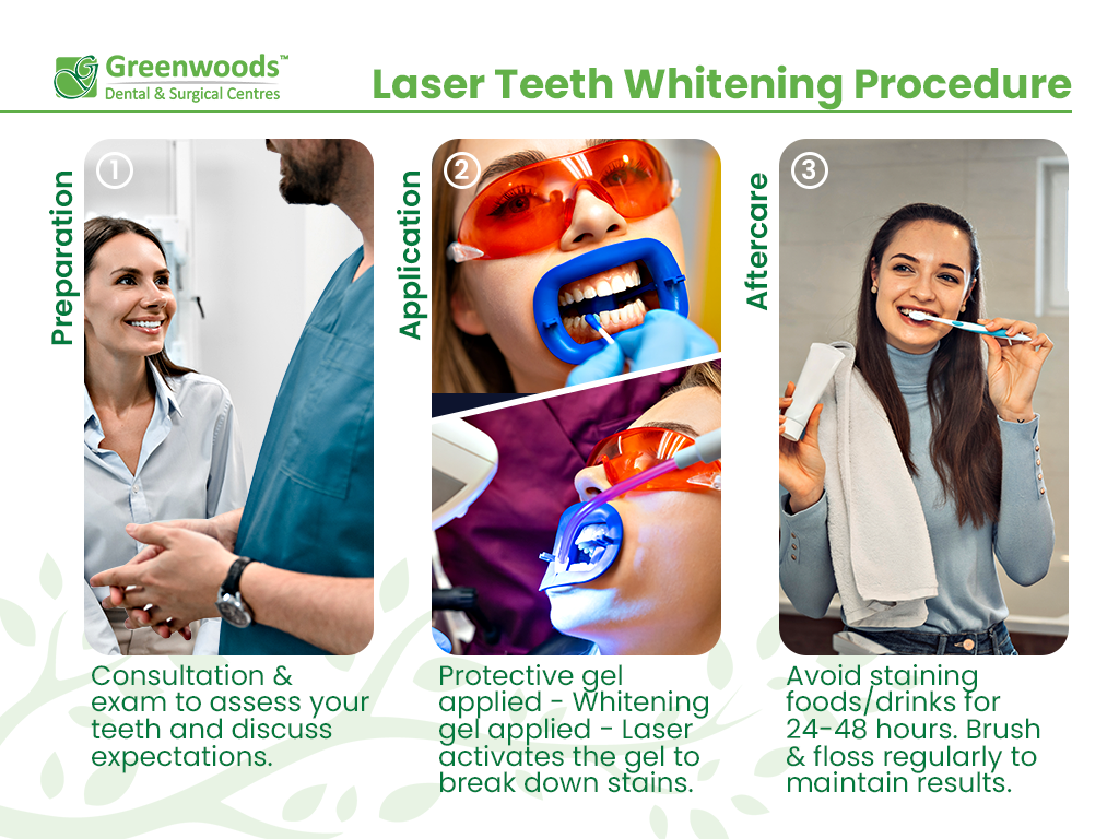 Laser Teeth Whitening Procedure step-by-step