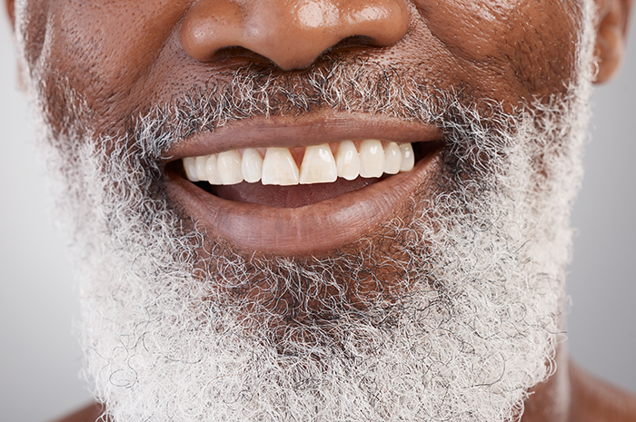 Partial & Full Dentures in Vancouver