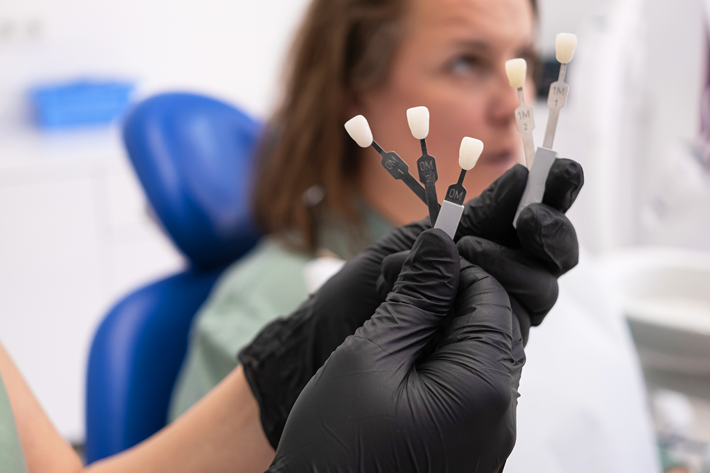 Dentist holding teeth color samples