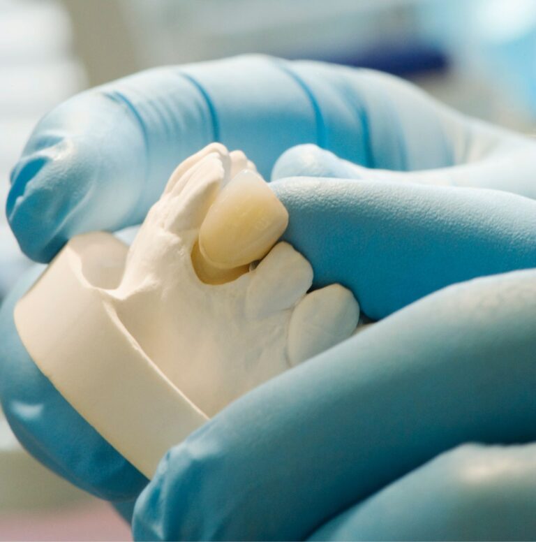 Tooth-Colored Restorations