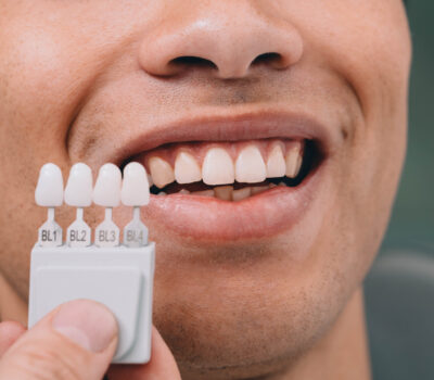 Doctor showing dental veneers to the patient