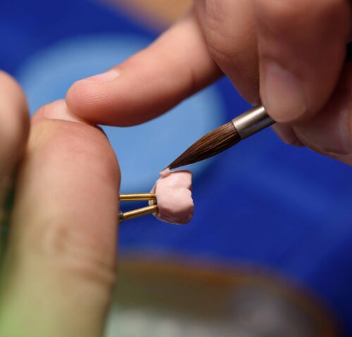 dental lab assistant modelling a custom crown
