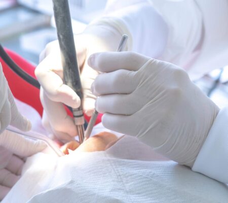 periodontics surgery