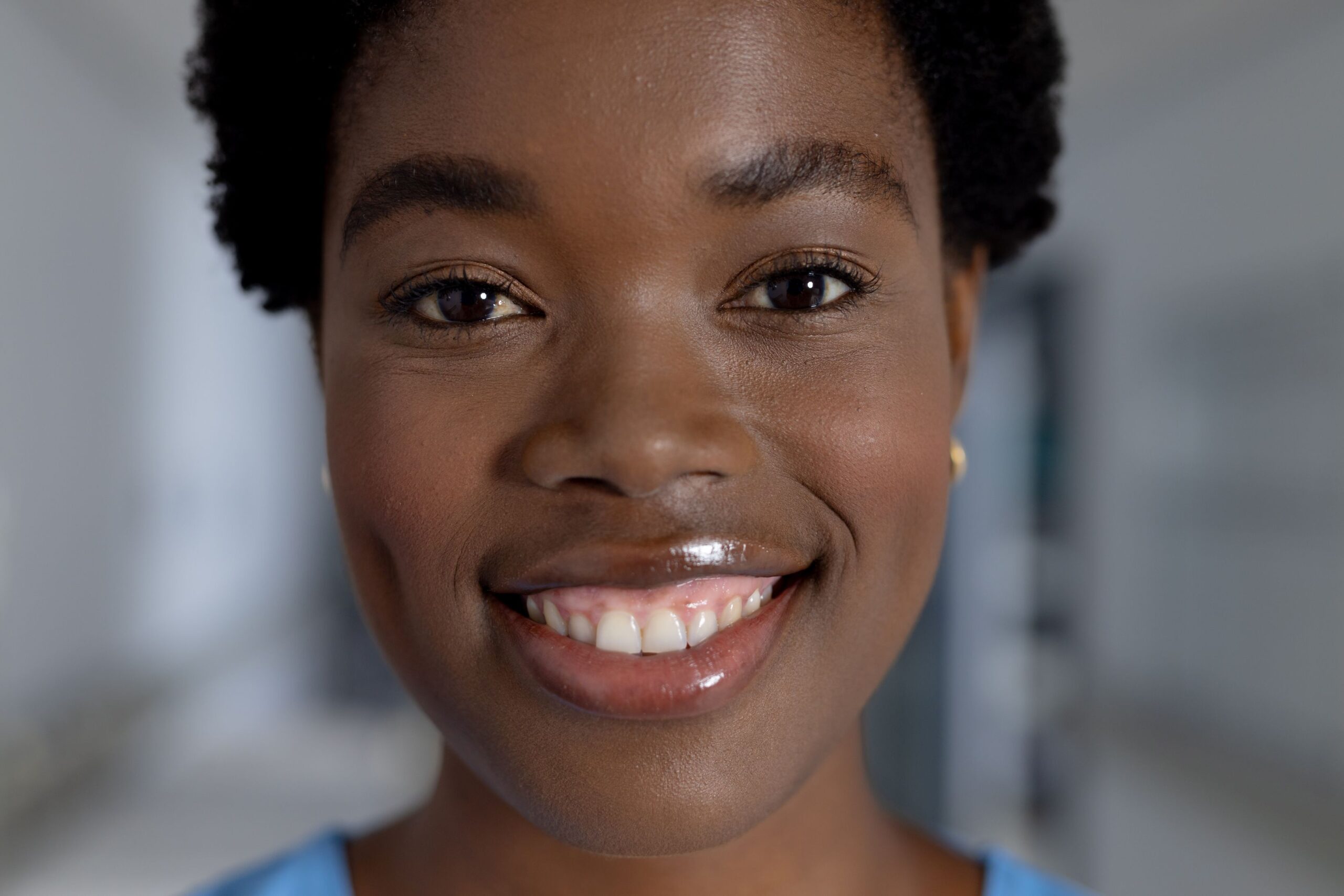 Advanced Gum Contouring in Winnipeg Dental Clinic